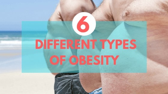 types of obese people