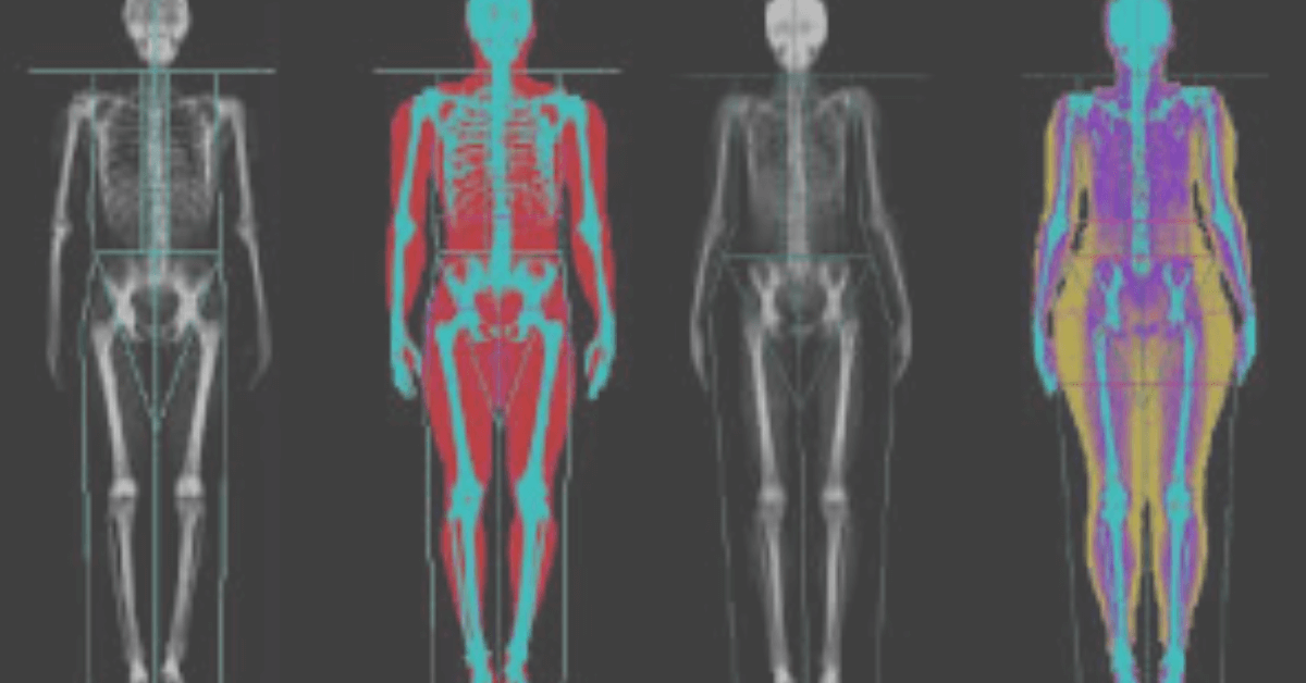 DEXA Body Fat Percentage