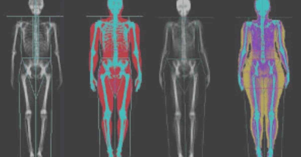 DEXA Body Fat Percentage 20 Fit